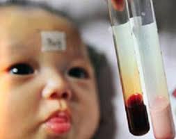 معاون بهداشت دانشگاه علوم پزشکی شیراز مراقبت‌های ویژه شرایط فرزندآوری برای ناقلین تالاسمی در فارس را فراهم کرده است